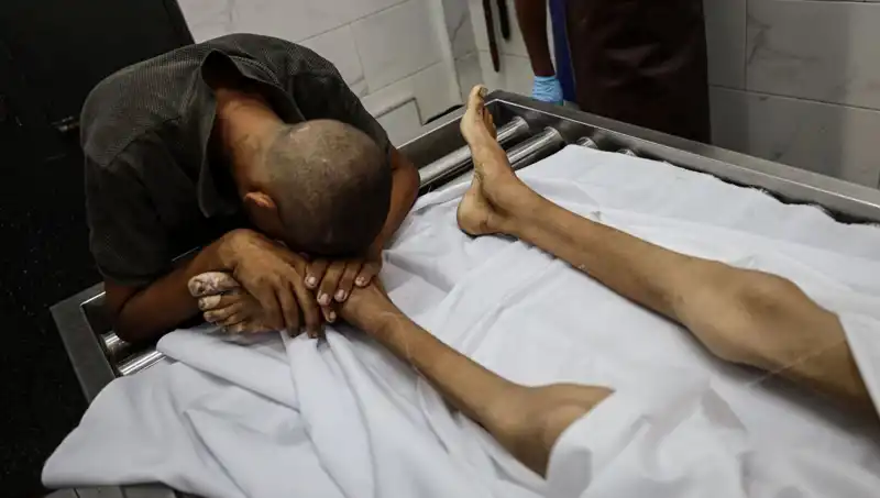 Gazze'de Açlık Kurbanı: Bir Çocuk Hayata Veda Etti