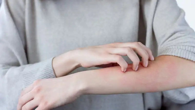 Cilt Kanseri Belirtilerine Dikkat: Dermatologdan Uyarılar